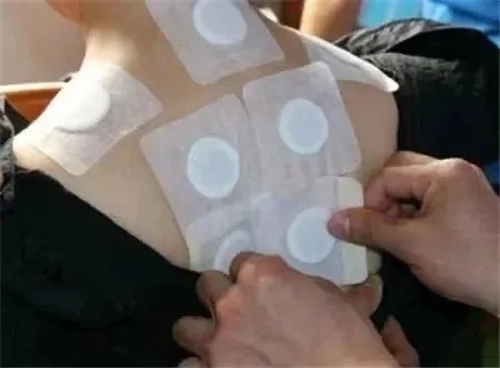 三伏貼 (2).jpg